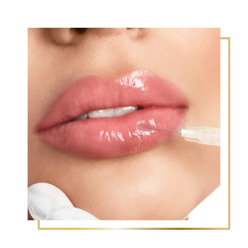 Ajakfeltöltés eredmény