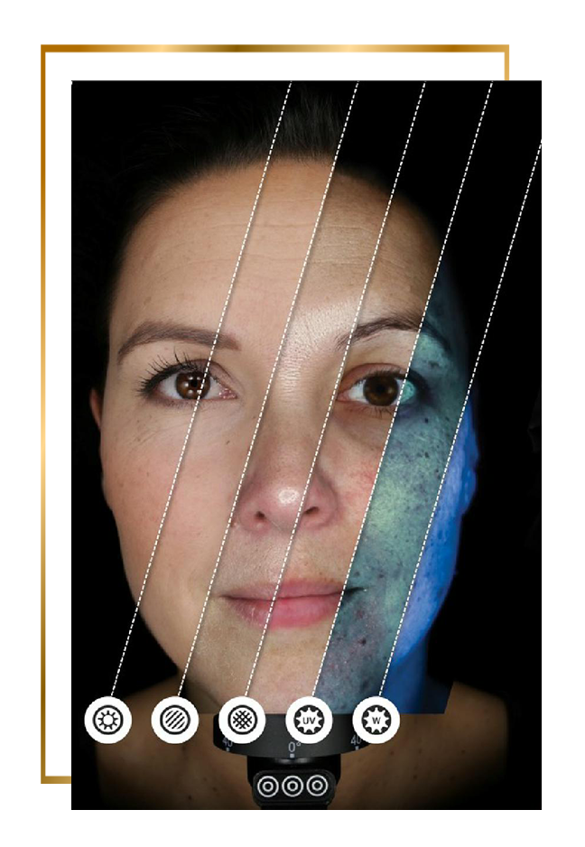 Observ bőrdiagnosztika vizsgálat