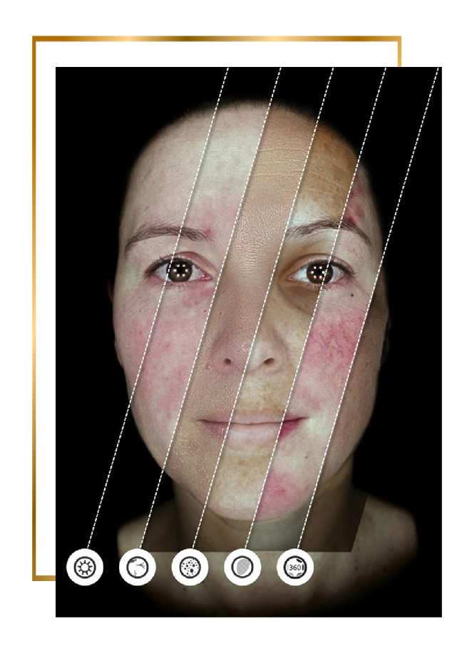 Observ 520x arcdiagnosztika eredmények